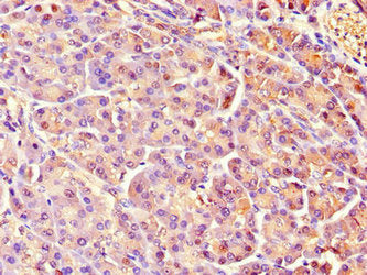 Immunohistochemistry of paraffin-embedded human pancreatic tissue using CSB-PA019546LA01HU at dilution of 1:100