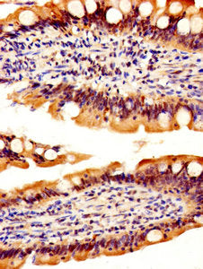 IHC image of CSB-PA019548EA01HU diluted at 1:500 and staining in paraffin-embedded human small intestine tissue performed on a Leica BondTM system. After dewaxing and hydration, antigen retrieval was mediated by high pressure in a citrate buffer (...