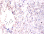 Immunohistochemistry of paraffin-embedded mouse liver tissue using CSB-PA019557LA01HU at dilution of 1:100