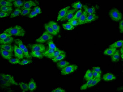 Immunofluorescence staining of HepG2 cells with CSB-PA019559LA01HU at 1:133, counter-stained with DAPI. The cells were fixed in 4% formaldehyde, permeabilized using 0.2% Triton X-100 and blocked in 10% normal Goat Serum. The cells were then incuba...