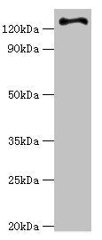 Western blot All lanes: RET antibody at 6ug/ml + Hela whole cell lysate Secondary Goat polyclonal to rabbit IgG at 1/10000 dilution Predicted band size: 125, 120 kDa Observed band size: 125 kDa