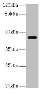 Western blot All lanes: RFPL2 antibody at 3.36µg/ml + MCF-7 whole cell lysate Secondary Goat polyclonal to rabbit IgG at 1/10000 dilution Predicted band size: 43, 33, 36 kDa Observed band size: 43 kDa