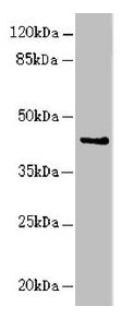 Western blot All lanes: RFPL2 antibody at 3.41µg/ml + MCF-7 whole cell lysate Secondary Goat polyclonal to rabbit IgG at 1/10000 dilution Predicted band size: 43, 33, 36 kDa Observed band size: 43 kDa