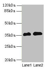 Western blot All lanes: RFPL3 antibody at 8µg/ml Lane 1: Human placenta tissue Lane 2: HL60 whole cell lysate Secondary Goat polyclonal to rabbit IgG at 1/10000 dilution Predicted band size: 36, 33 kDa Observed band size: 36 kDa