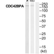 Western blot analysis of extracts from Jurkat/COLO205 cells, using MRCKa antibody.