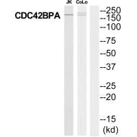 Western blot analysis of extracts from Jurkat/COLO205 cells, using MRCKa antibody.