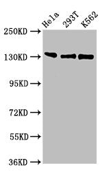 Western Blot Positive WB detected in: Hela whole cell lysate, 293T whole cell lysate, K562 whole cell lysate All lanes: RFX1 antibody at 3ug/ml Secondary Goat polyclonal to rabbit IgG at 1/50000 dilution Predicted band size: 105 kDa Observed band...