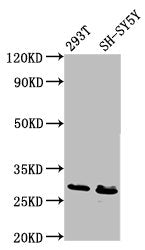 Western Blot Positive WB detected in: 293T whole cell lysate, SH-SY5Y whole cell lysate All lanes: RFXANK antibody at 6.7ug/ml Secondary Goat polyclonal to rabbit IgG at 1/50000 dilution Predicted band size: 29, 25, 26 kDa Observed band size: 29 kDa