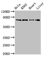 Western Blot Positive WB detected in: Hela whole cell lysate, K562 whole cell lysate, Mouse heart tissue, Rat liver tissue All lanes: RGL2 antibody at 3.2ug/ml Secondary Goat polyclonal to rabbit IgG at 1/50000 dilution Predicted band size: 84, 51...