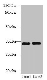 Western blot All lanes: Rgn antibody at 8µg/ml Lane 1: A549 whole cell lysate Lane 2: HCT116 whole cell lysate Secondary Goat polyclonal to rabbit IgG at 1/10000 dilution Predicted band size: 34 kDa Observed band size: 34 kDa