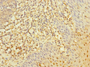 Immunohistochemistry of paraffin-embedded human tonsil tissue using CSB-PA019642ESR1HU at dilution of 1:100