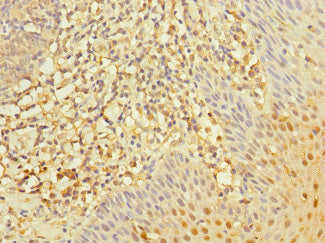 Immunohistochemistry of paraffin-embedded human tonsil tissue using CSB-PA019642ESR1HU at dilution of 1:100