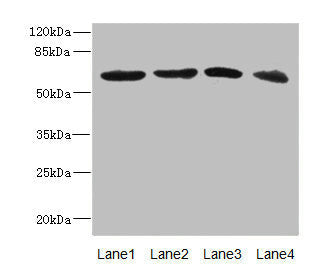Western blot All lanes: RGS14 antibody at 3.88ug/ml Lane 1: 293T whole cell lysate Lane 2: Hela whole cell lysate Lane 3: Jurkat whole cell lysate Lane 4: SH-SY5Y whole cell lysate Secondary Goat polyclonal to rabbit IgG at 1/10000 dilution Predic...