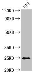 Western Blot Positive WB detected in: U87 whole cell lysate All lanes: RGS2 antibody at 3µg/ml Secondary Goat polyclonal to rabbit IgG at 1/50000 dilution Predicted band size: 25, 24, 23, 21 kDa Observed band size: 25 kDa