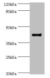 Western blot All lanes: RGS20 antibody at 8ug/ml + Mouse brain tissue Secondary Goat polyclonal to rabbit IgG at 1/10000 dilution Predicted band size: 44, 32, 22, 18, 26, 28 kDa Observed band size: 44 kDa