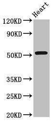 Western Blot Positive WB detected in: Rat heart tissue All lanes: RGS6 antibody at 8ug/ml Secondary Goat polyclonal to rabbit IgG at 1/50000 dilution Predicted band size: 55, 57, 54, 50, 51, 53, 52, 41, 56 kDa Observed band size: 55 kDa