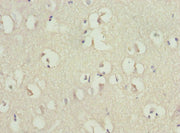 Immunohistochemistry of paraffin-embedded human brain tissue using CSB-PA019659ESR1HU at dilution of 1:100