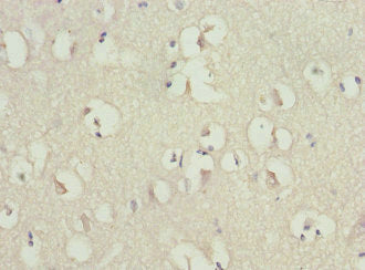 Immunohistochemistry of paraffin-embedded human brain tissue using CSB-PA019659ESR1HU at dilution of 1:100