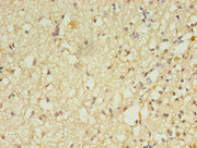 Immunohistochemistry of paraffin-embedded human brain tissue using CSB-PA019659LA01HU at dilution of 1:100