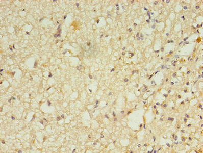 Immunohistochemistry of paraffin-embedded human brain tissue using CSB-PA019659LA01HU at dilution of 1:100