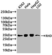Western Blot Positive WB detected in: K562 whole cell lysate(20µg), Hela whole cell lysate(20µg), HepG2 whole cell lysate(20µg), LO2 whole cell lysate(20µg) All lanes: RHD antibody at 1:1000 Secondary Goat polyclonal to rabbit IgG at 1/20000 dilut...