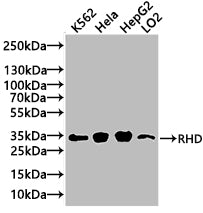 Western Blot Positive WB detected in: K562 whole cell lysate(20µg), Hela whole cell lysate(20µg), HepG2 whole cell lysate(20µg), LO2 whole cell lysate(20µg) All lanes: RHD antibody at 1:1000 Secondary Goat polyclonal to rabbit IgG at 1/20000 dilut...