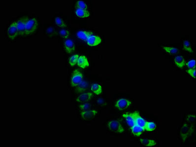 Immunofluorescence staining of PC3 cells with CSB-PA019681HA01HU at 1:133, counter-stained with DAPI. The cells were fixed in 4% formaldehyde, permeabilized using 0.2% Triton X-100 and blocked in 10% normal Goat Serum. The cells were then incubate...