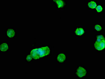 Immunofluorescence staining of MCF-7 cells with CSB-PA019683LA01HU at 1:100, counter-stained with DAPI. The cells were fixed in 4% formaldehyde, permeabilized using 0.2% Triton X-100 and blocked in 10% normal Goat Serum. The cells were then incuba...