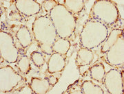 Immunohistochemistry of paraffin-embedded human thyroid tissue using CSB-PA019684ESR1HU at dilution of 1:100