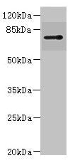 Western blot All lanes: RHOBTB1 antibody IgG at 3.17ug/ml + 293T whole cell lysate Secondary Goat polyclonal to rabbit IgG at 1/10000 dilution Predicted band size: 79 kDa Observed band size: 79 kDa