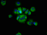 Immunofluorescence staining of MCF-7 cells with CSB-PA019688LA01HU at 1:66, counter-stained with DAPI. The cells were fixed in 4% formaldehyde, permeabilized using 0.2% Triton X-100 and blocked in 10% normal Goat Serum. The cells were then incubat...