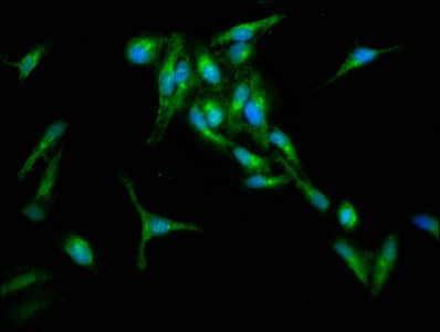 Immunofluorescence staining of Hela cells with CSB-PA019726LA01HU at 1:133, counter-stained with DAPI. The cells were fixed in 4% formaldehyde, permeabilized using 0.2% Triton X-100 and blocked in 10% normal Goat Serum. The cells were then incubat...