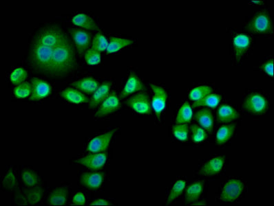 Immunofluorescence staining of Hela cells with CSB-PA019728LA01HU at 1:133, counter-stained with DAPI. The cells were fixed in 4% formaldehyde, permeabilized using 0.2% Triton X-100 and blocked in 10% normal Goat Serum. The cells were then incubat...