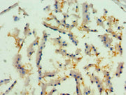 Immunohistochemistry of paraffin-embedded human prostate tissue using CSB-PA019736ESR1HU at dilution of 1:100