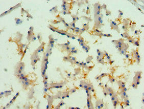 Immunohistochemistry of paraffin-embedded human prostate tissue using CSB-PA019736ESR1HU at dilution of 1:100
