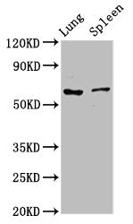 Western Blot Positive WB detected in: Rat lung tissue, Rat spleen tissue All lanes: RIPK2 antibody at 2.7µg/ml Secondary Goat polyclonal to rabbit IgG at 1/50000 dilution Predicted band size: 62, 46 kDa Observed band size: 62 kDa