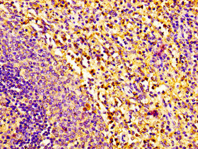 IHC image of CSB-PA019794LA01HU diluted at 1:100 and staining in paraffin-embedded human spleen tissue performed on a Leica BondTM system. After dewaxing and hydration, antigen retrieval was mediated by high pressure in a citrate buffer (pH 6.0)....