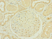 Immunohistochemistry of paraffin-embedded human kidney tissue using CSB-PA019800LA01HU at dilution of 1:100