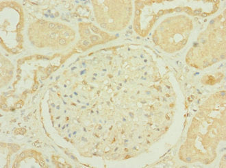 Immunohistochemistry of paraffin-embedded human kidney tissue using CSB-PA019800LA01HU at dilution of 1:100