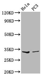 Western Blot Positive WB detected in: Hela whole cell lysate, PC-3 whole cell lysate All lanes: RNASEH1 antibody at 3.59µg/ml Secondary Goat polyclonal to rabbit IgG at 1/50000 dilution Predicted band size: 33 kDa Observed band size: 33 kDa