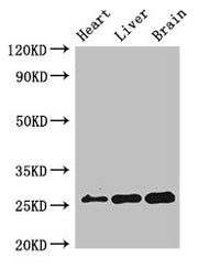 Western Blot Positive WB detected in: Mouse heart tissue, Mouse liver tissue, Mouse brain tissue All lanes: RND2 antibody at 2ug/ml Secondary Goat polyclonal to rabbit IgG at 1/50000 dilution Predicted band size: 26 kDa Observed band size: 26 kDa
