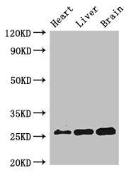 Western Blot Positive WB detected in: Mouse heart tissue, Mouse liver tissue, Mouse brain tissue All lanes: RND2 antibody at 2ug/ml Secondary Goat polyclonal to rabbit IgG at 1/50000 dilution Predicted band size: 26 kDa Observed band size: 26 kDa