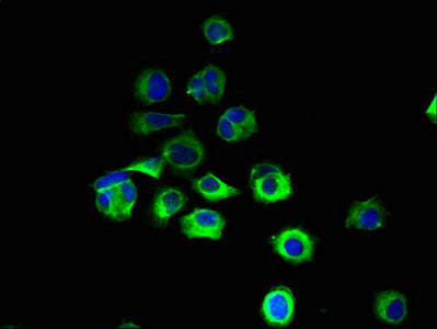 Immunofluorescent analysis of MCF-7 cells using CSB-PA019815LA01HU at dilution of 1:100 and Alexa Fluor 488-congugated AffiniPure Goat Anti-Rabbit IgG(H+L)