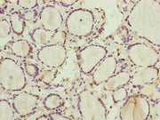 Immunohistochemistry of paraffin-embedded human thyroid tissue using CSB-PA019816ESR1HU at dilution of 1:100