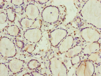 Immunohistochemistry of paraffin-embedded human thyroid tissue using CSB-PA019816ESR1HU at dilution of 1:100