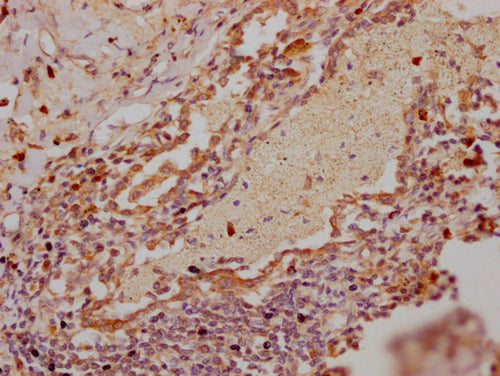 IHC image of CSB-PA019825LA01HU diluted at 1:300 and staining in paraffin-embedded human lung tissue performed on a Leica BondTM system. After dewaxing and hydration, antigen retrieval was mediated by high pressure in a citrate buffer (pH 6.0). Se...