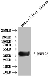 Western Blot Positive WB detected in: Mouse Liver tissue lysate All lanes: RNF126 antibody at 1:5000 Secondary Goat polyclonal to rabbit IgG at 1/50000 dilution Predicted band size: 36 kDa Observed band size: 36 kDa