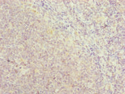 Immunohistochemistry of paraffin-embedded human tonsil tissue using CSB-PA019831DSR1HU at dilution of 1:100