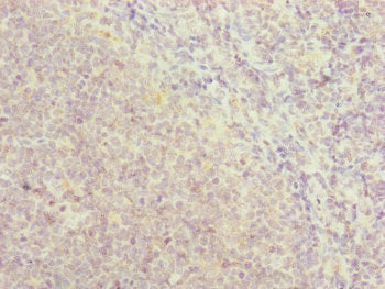 Immunohistochemistry of paraffin-embedded human tonsil tissue using CSB-PA019831DSR1HU at dilution of 1:100