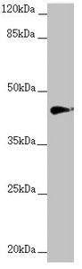 Western blot All lanes: RNF13 antibody at 1.22µg/ml + MCF-7 whole cell lysate Secondary Goat polyclonal to rabbit IgG at 1/10000 dilution Predicted band size: 43, 30 kDa Observed band size: 43 kDa